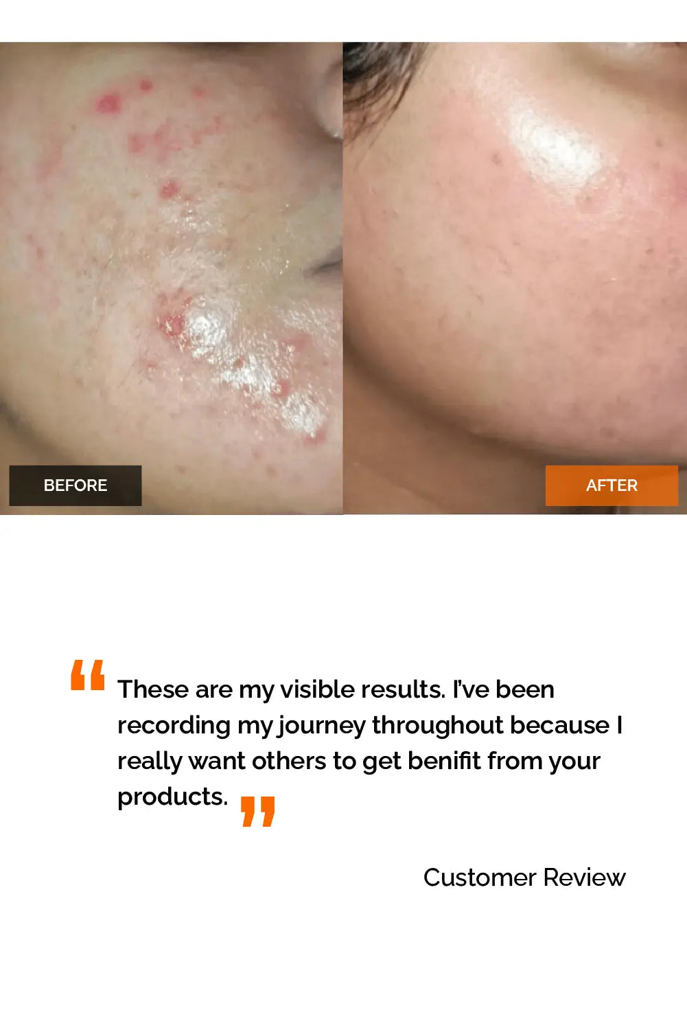 Salicylic Acid 2% Serum